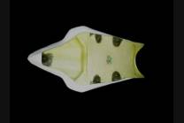 Hoecker mit unter Hoecker 2