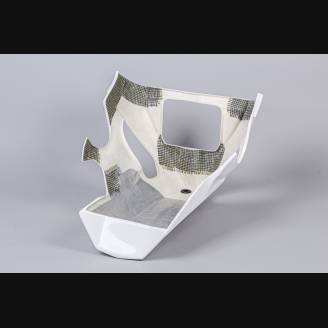 Race-Paket Yamaha R1 2015 - 2019 : Verkleidungen + Schnellverschluss + Screws - MXPCRD12712