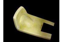 Unter Hoecker - MXPVCR3798 2